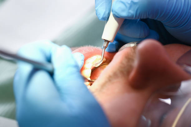 Best Emergency Broken Tooth Repair in Gardnertown, NY