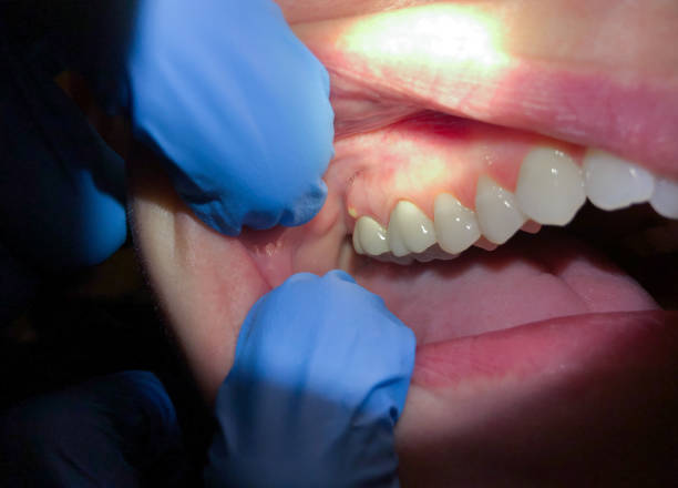 Best Emergency Orthodontic Repairs in Gardnertown, NY